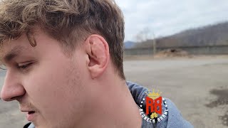 Chico To Pop Short Fuses Ear Like A Zit This Sat. March 4