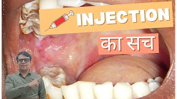 OSMF Expert Shares Top Injection Techniques!