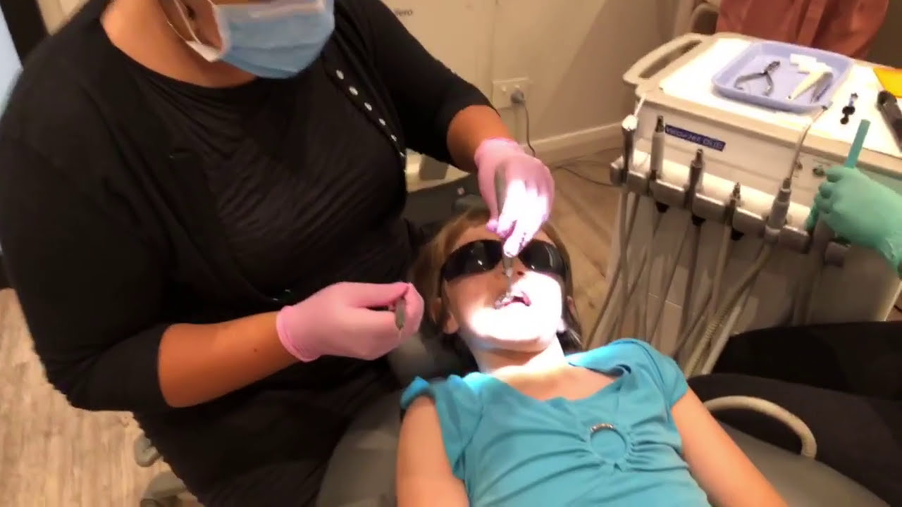 How to cement rapid maxillary expander - Clinical tip by BOSS Orthodontics