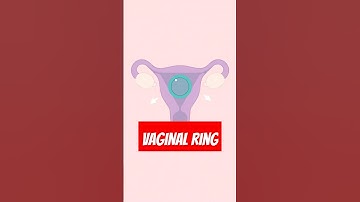 Vaginal Ring Birth Control Explained: How It Works, Effectiveness, & Side Effects #shorts