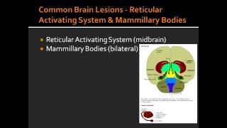 Common Brain Lesions - Reticular Activating System & Mammillary Bodies