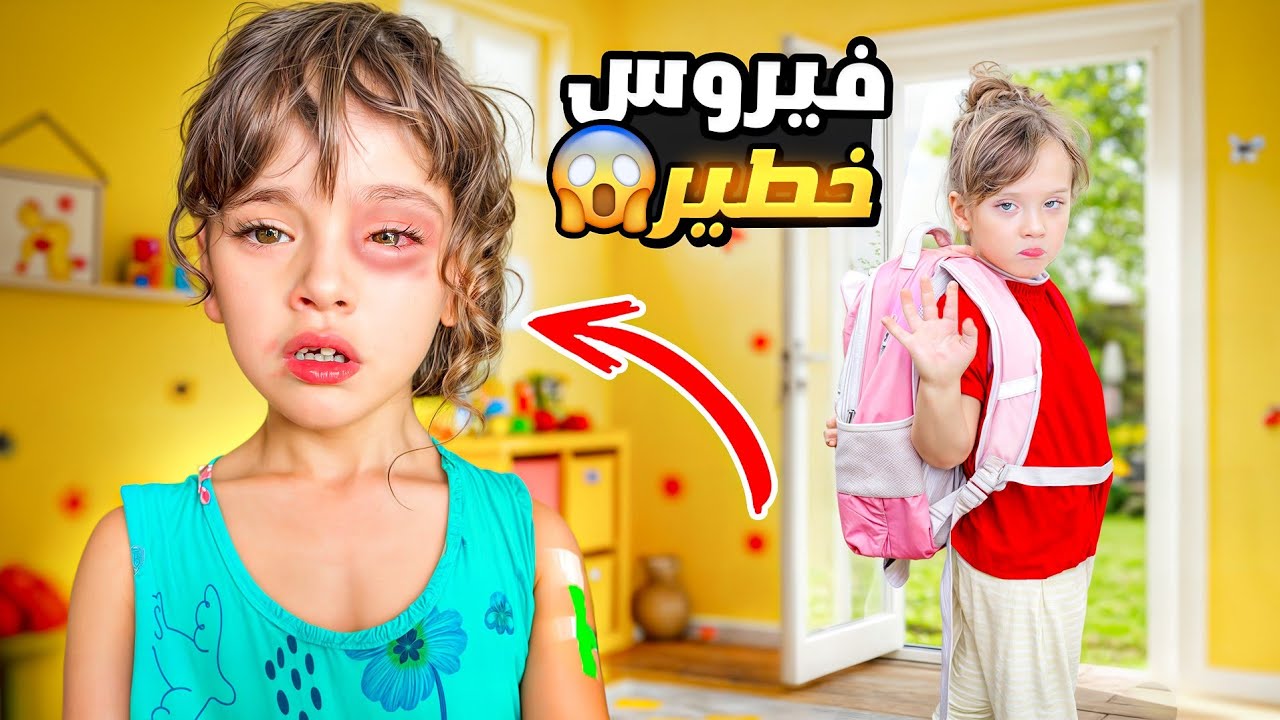 ماريا مريضة كتير صابها فيروس القطط !