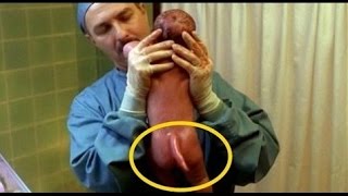 Bebe nace con cola y cuernos en PERU ChicoMALO