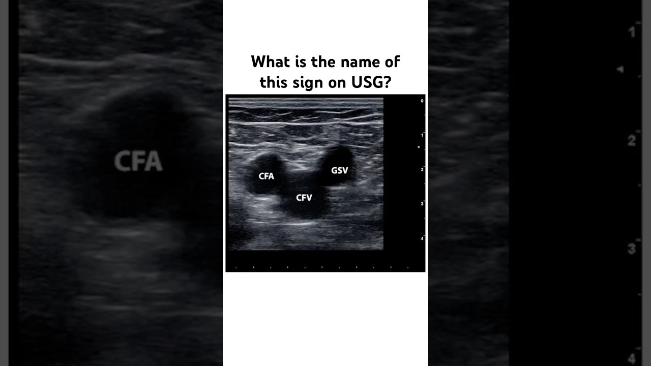 Ultrasound Image Quiz? Wait for the answer 