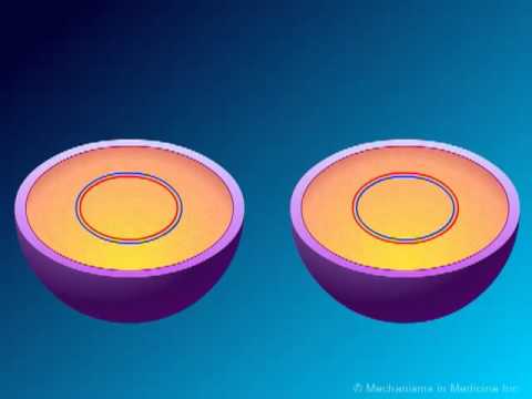 Fluoroquinolones  Mechanisms of Action and Resistance