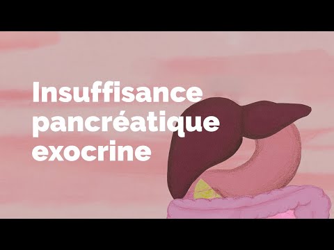 Vidéo: Troubles Gastro-intestinaux Mal Diagnostiqués: Insuffisance Pancréatique Exocrine Et Plus