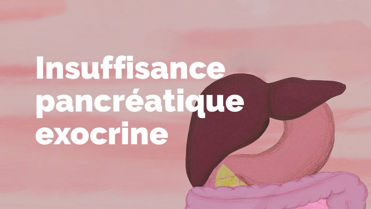 Insuffisance Pancreatique Exocrine Societe Gastro Intestinale Www Mauxdeventre Org Insuffisance Pancreatique Exocrine Societe Gastro Intestinale Www Mauxdeventre Org