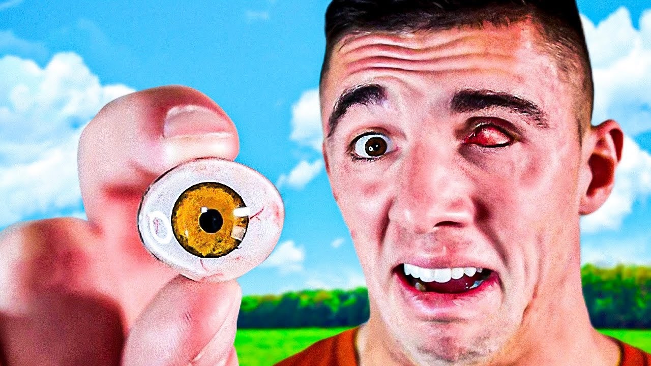 WEARING A STRANGERS EYEBALL!