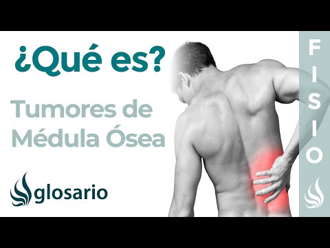 Vídeo: El Sarcoma Espinal Es Una Enfermedad Rara Pero Peligrosa