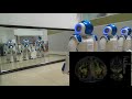 Multiple Robots take the challenge of Mirror Test through their robot bodily self models