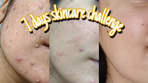 How can I get flawless skin in 2 weeks?
