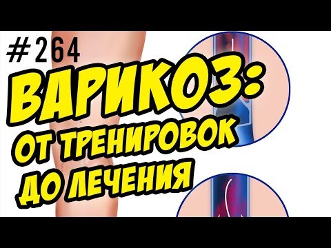 варикоз. варикоз и фитнес. причины и лечение варикоза. всё про варикоз