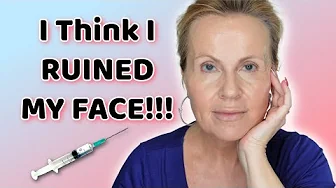 I Got LIP FILLER & FACE FILLERS for the FIRST TIME! Women Over 50