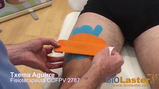 Vendaje Neuromuscular para la Rotura Fibrilar