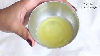 Get Rid of dandruff in 1 Day! _ Instant Dandruff Remedy at Home screenshot 5