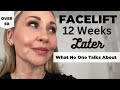 Facelift 12 weeks later all the details