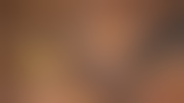 A Stepwise Approach to LAR. An Illustrated Video for Training Colorectal Surgeons