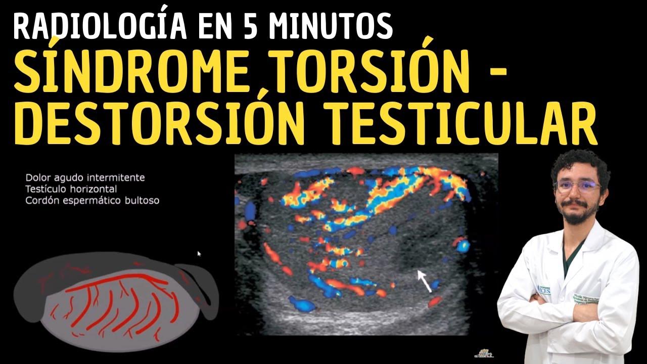 Radiología en 5 minutos Síndrome Torsión Destorsión Testicular
