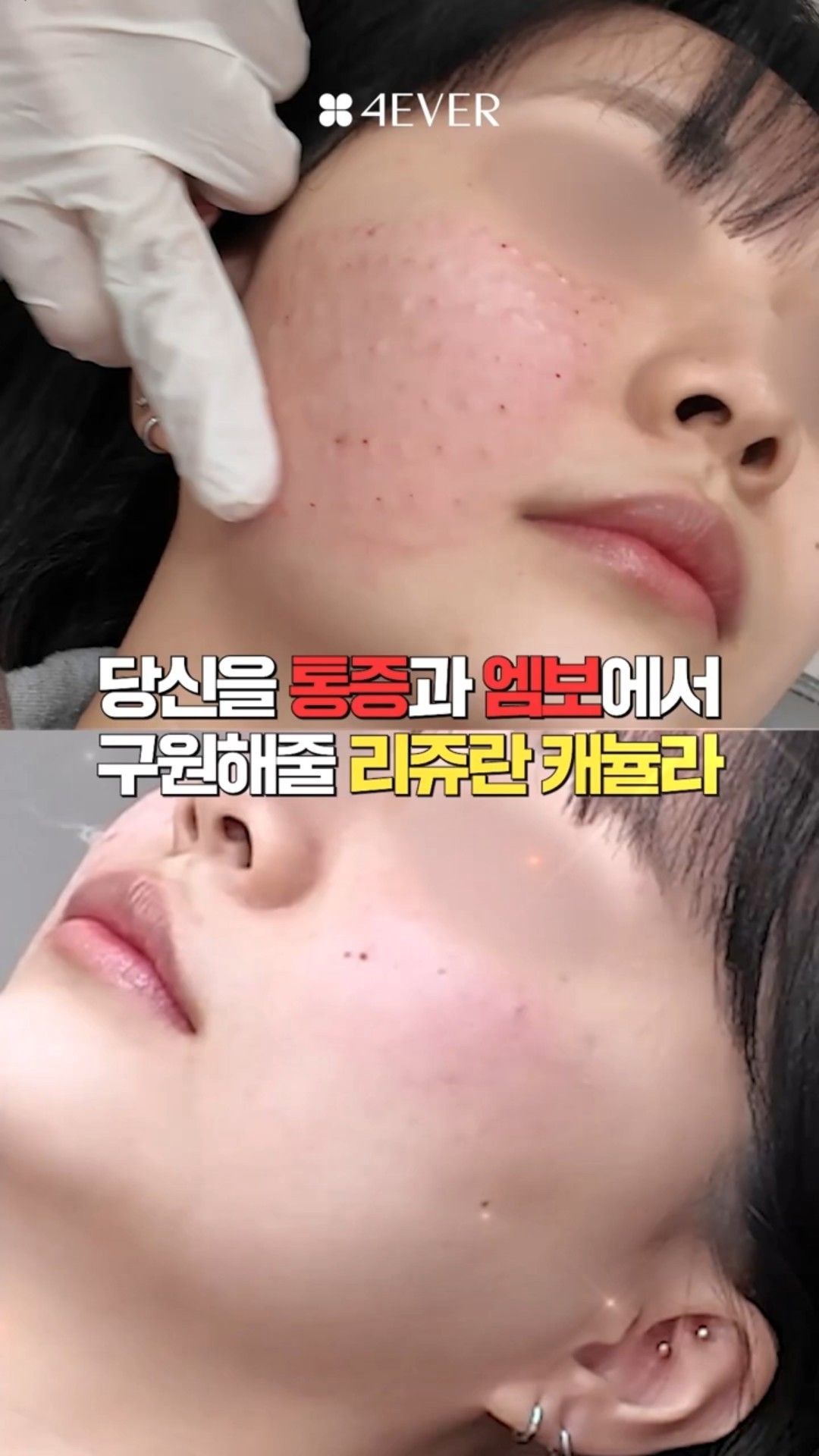 쇼츠