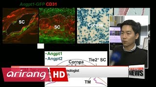 Korean researchers discover path to new glaucoma treatment methods