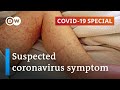 Coronavirus suspected of causing rare childhood disease | COVID-19 Special