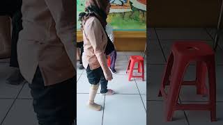 Pemasangan Kaki Palsu Info Kaki Palsu No Wa 082280777190