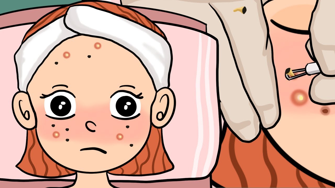 Asmr Squeeze blackheads, pustules on the face / Animation YouTube