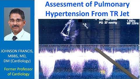 Assessment of Pulmonary Hypertension From TR Jet