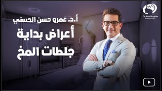 أعراض بداية جلطات المخ -أ.د.عمرو حسن الحسني أستاذ المخ والأعصاب