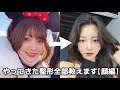 今までにしてきた整形｜顔編【ゆいぴすご飯】