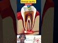 #dental#cavitytreatment#human#body🏥💉🩺🏥💉🏥🩺🏥💉🏥🩺💉