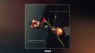 Kaleem Taylor - Scars On My Skin