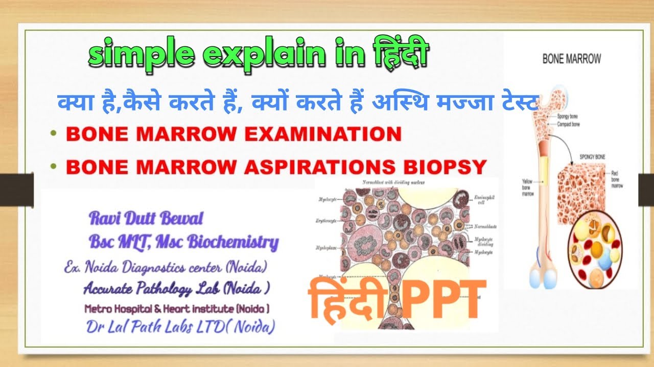 Bone Marrow ExaminationBone marrow TestBMEअस्थि मज्जा क्या होता है ।हिंदी R D MEDICAL SCIENCE