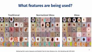 Debiasing Skin Lesion Datasets and Models? Not So Fast