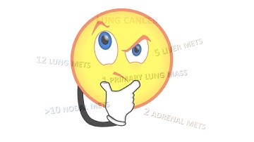 How accurate is RECIST 1.1 for assessing tumor response?