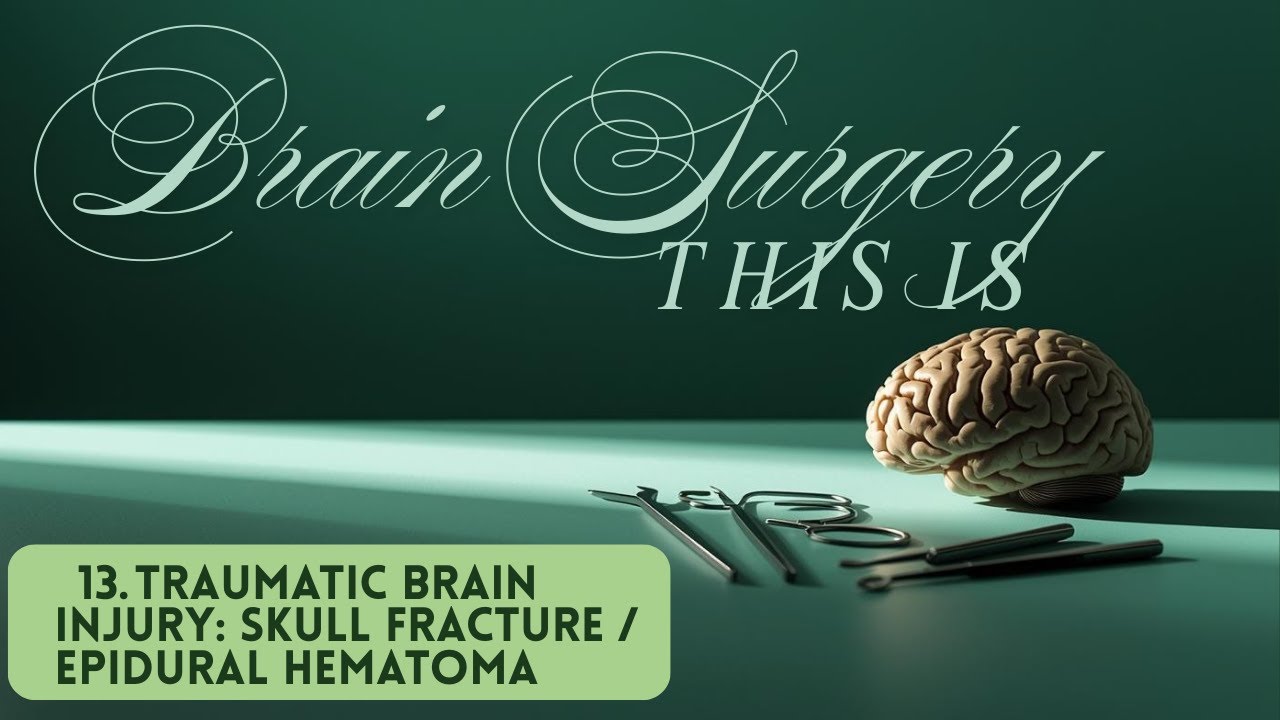 This is Brain Surgery 13: Traumatic Brain Injury Part 2, Skull Fractures, Epidural Hematoma