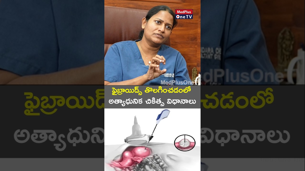 Fibroid Removal: Advanced Method Available Without Surgery l Dr. Vasundara Cheepurupalli