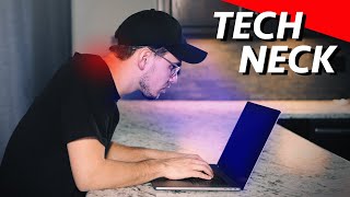 Stop Harming Yourself With Poor Posture | Avoid Tech Neck
