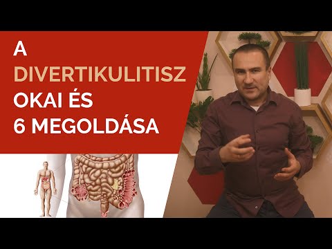 Videó: Egyszerű módszerek az influenza diagnosztizálására: 9 lépés (képekkel)