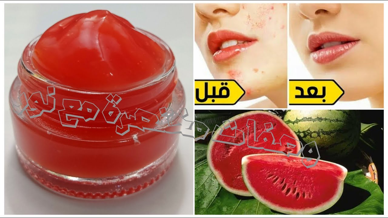 كريم البطيخ والنشا // مذهل في تفتيح وترطيب البشرة ويقضي علي حب الشباب والبقع والبثور ومضاد للشيخوخة🔝