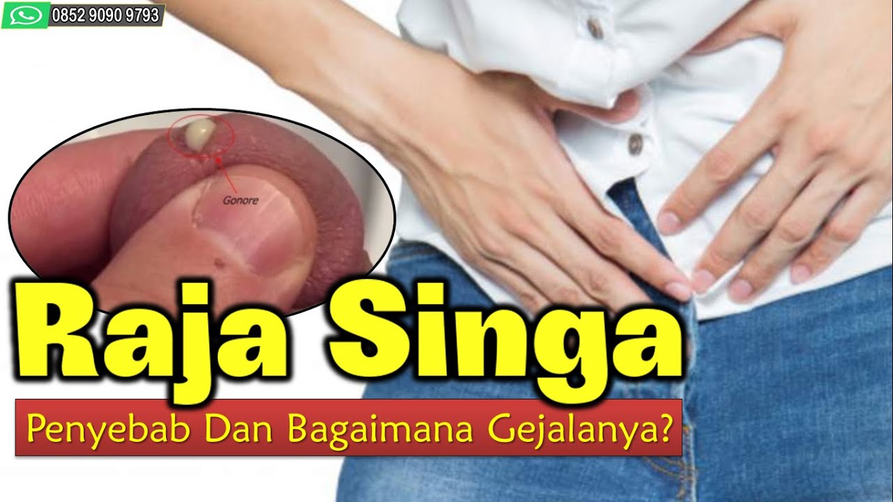 Raja singa : penyebab dan bagaimana gejalanya? - YouTube