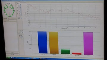 Explore Emotiv Epoc TestBench V1.5 EEG Research Edition  Not a Tutorial
