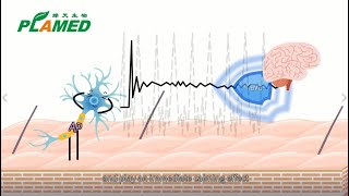 Skin Soothing New Target is not only TRPV1, but also AP (action potentials)