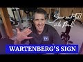 Wartenberg's Sign - Ulnar Nerve Injury