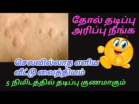 தோல் தடிப்பு அலர்ஜி குணமாக/ solution for skin diseases/skin allergy treatment intamil/GK homely tips