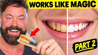How To Whiten Your Teeth With Turmeric Safely & Naturally Part 2 (10 Years Later)