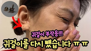 귀걸이 부작용으로 엄마가 귀수술을 했어요 ㅠㅠ (귀걸이 다시 뺐어요 이제 다시 할 수 없을까)  귀염증 치료 마이맘 일상 브이로그 | 마이린 TV