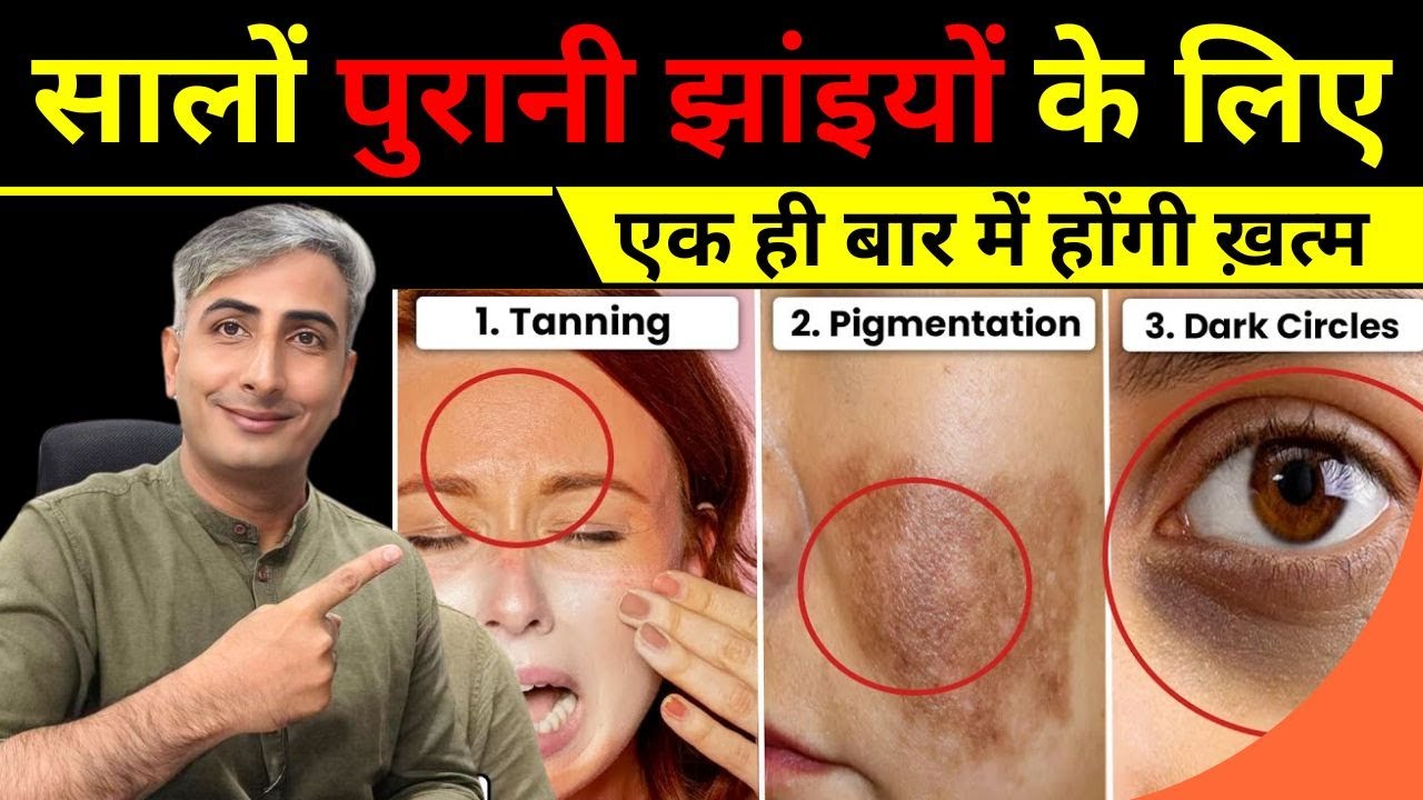 Pigmentation & Dark Spots का 100% इलाज (Treatment) Naturally I DR. MANOJ DAS 