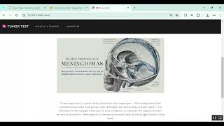Brain Tumor Detection Analyze and Classification in Python Projects
