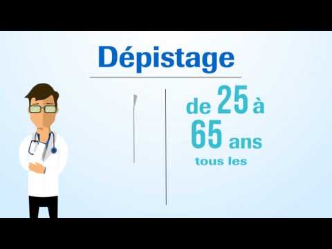 Vidéo: Cancer Du Col Utérin: Diagnostic